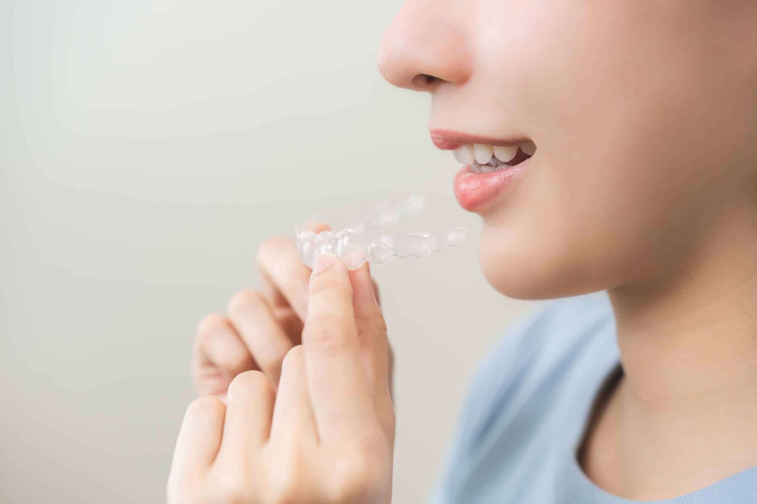 Dental,Invisible,Braces,,Beautiful,Smiling,Asian,Young,Woman,Holding,Invisalign